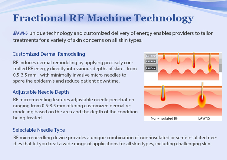 Sincoheren RF-301 Fractional Microneedling RF Machine for sale